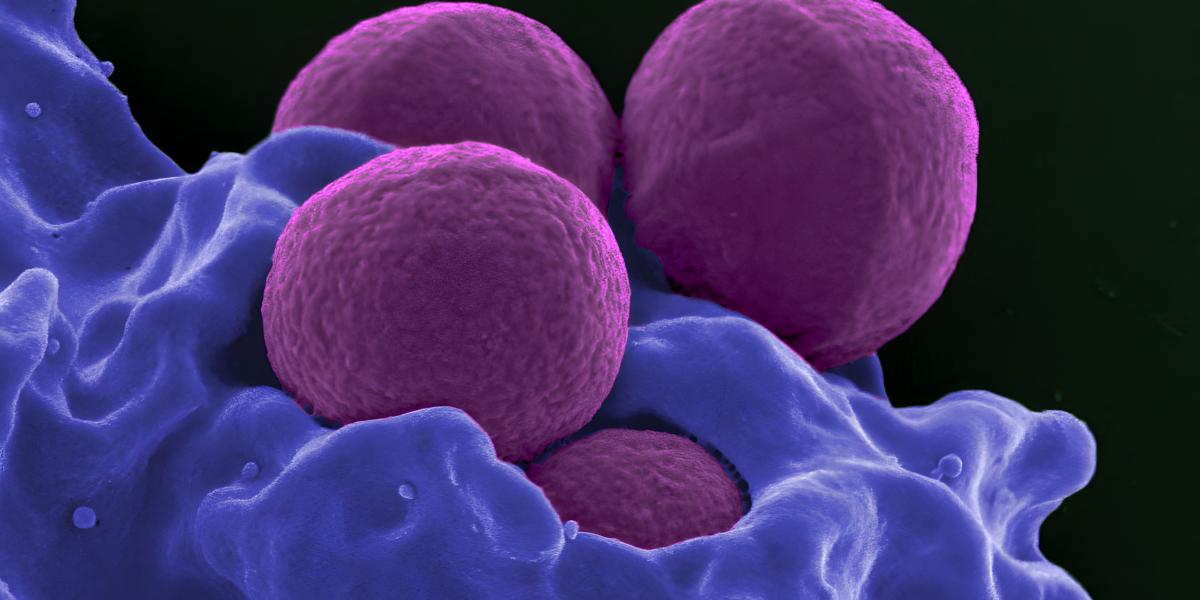 Egy multirezisztens baktérium, a staphylococcus aureus