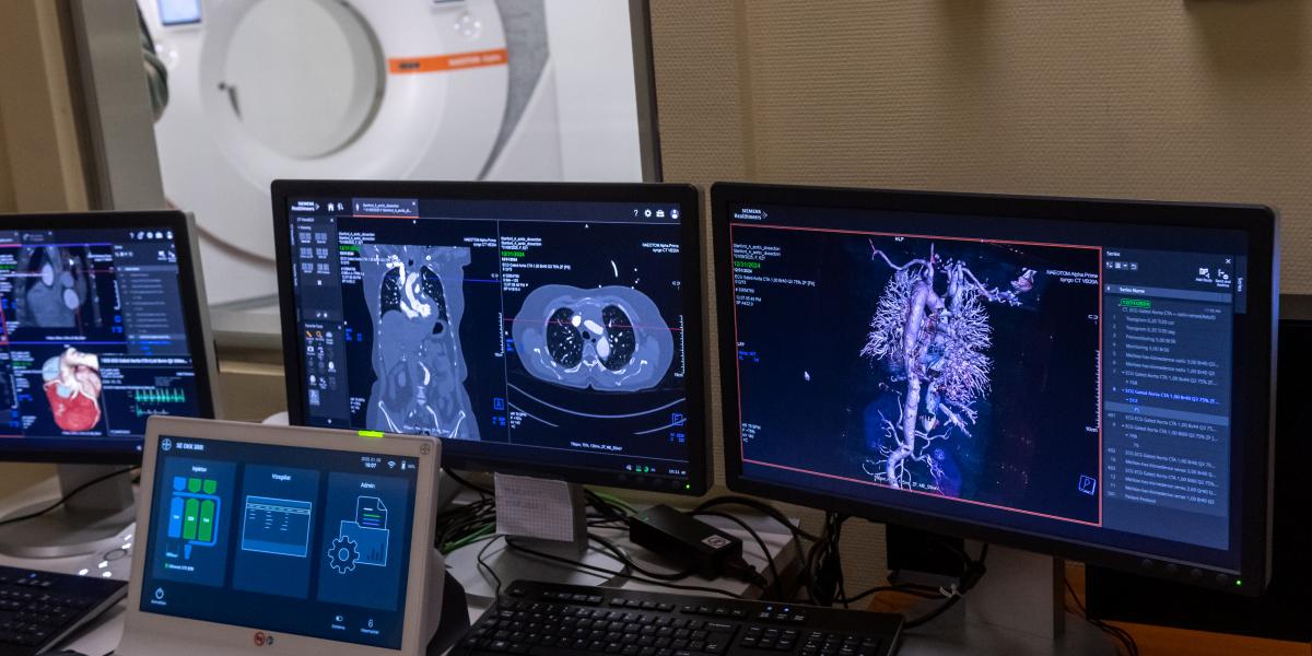 Új generációs CT-készülék a Semmelweis Egyetemen. A valódi fordulathoz más lépések is kellenek