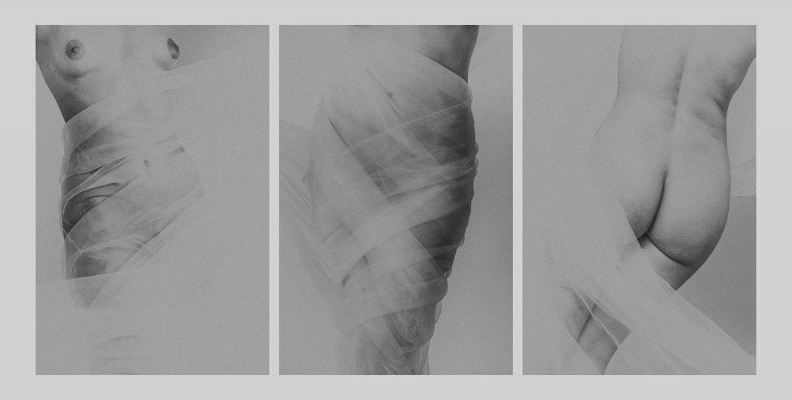 I. díj négy képes kollekcióra: Przybyszowska Alicja - Absolute beauty... -2. (digitális print)