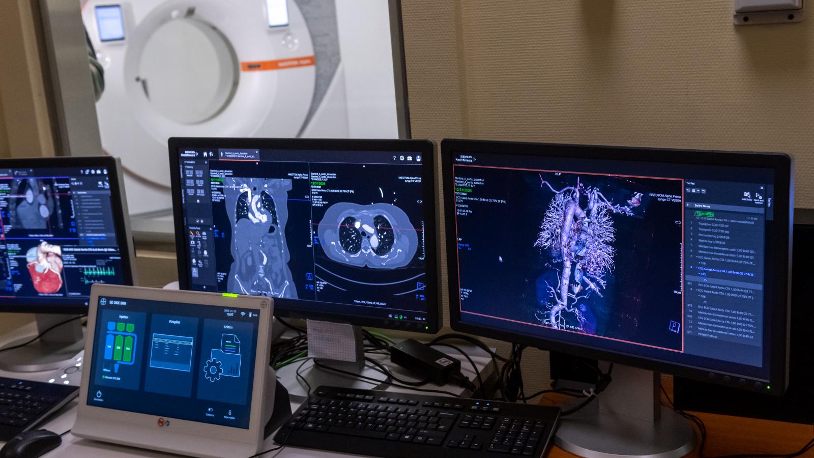 Új generációs CT-készülék a Semmelweis Egyetemen. A valódi fordulathoz más lépések is kellenek